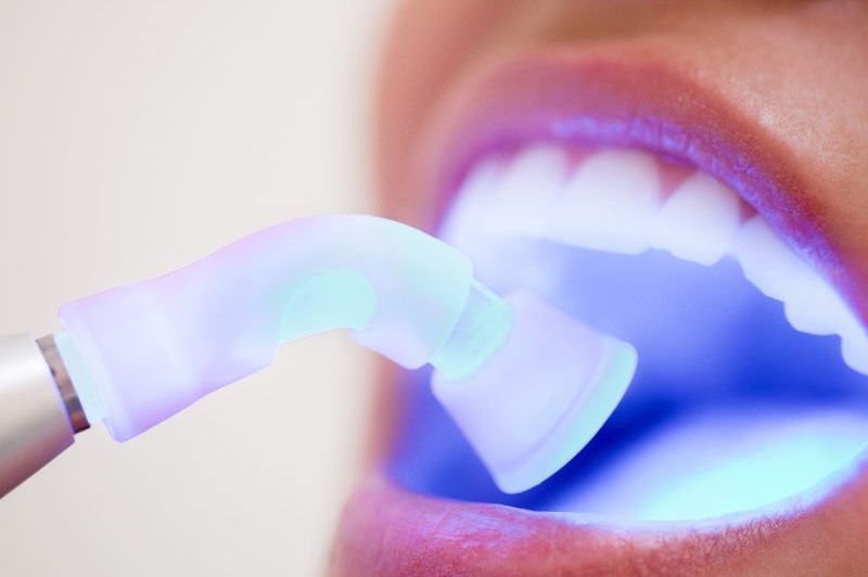 دندانپزشکی طرف قرارداد بیمه ایران غرب تهران