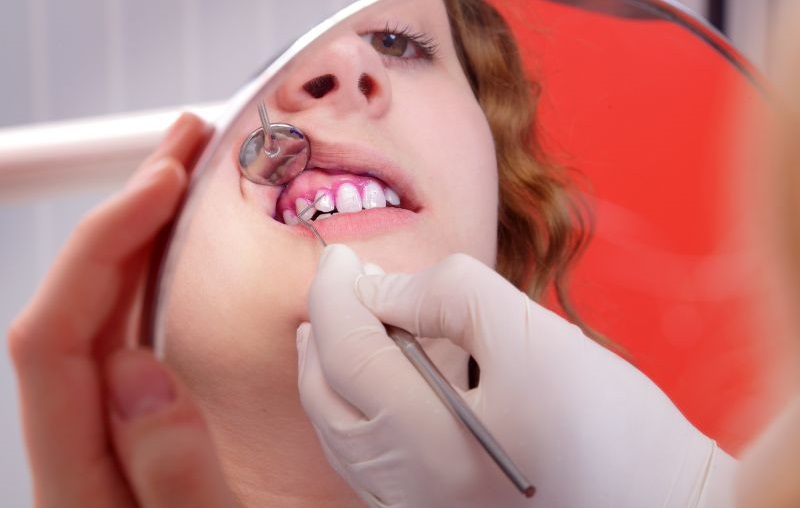 متخصص لثه در غرب تهران