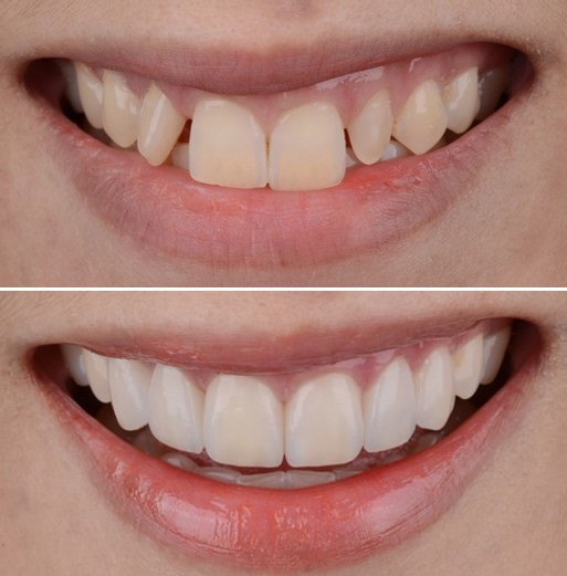 بهترین دندانپزشک کامپوزیت تهران