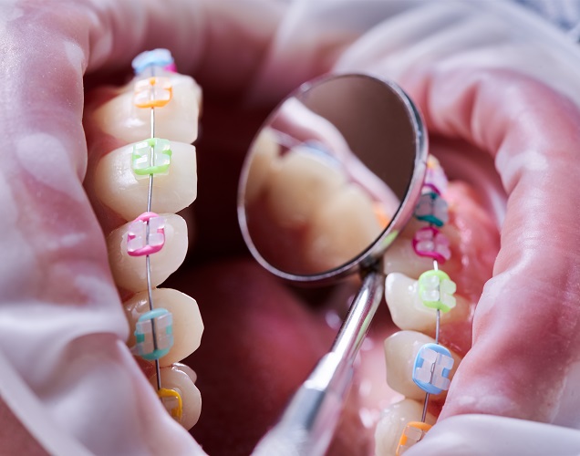 متخصص ارتودنسی در غرب تهران