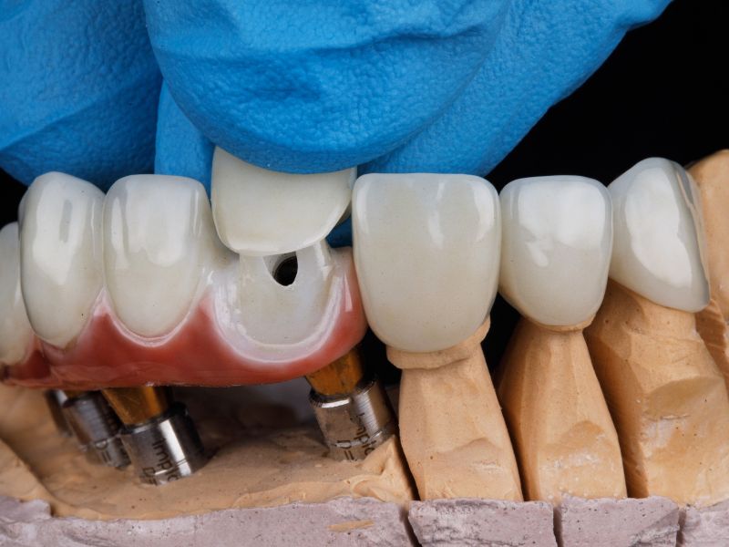 دندانپزشکی طرف قرارداد با بیمه تکمیلی در تهران