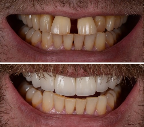 بهترین دندانپزشک کامپوزیت کرمانشاه