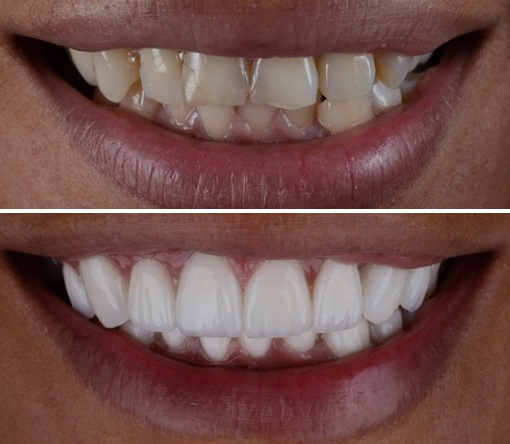 قیمت کامپوزیت اقساطی اردبیل