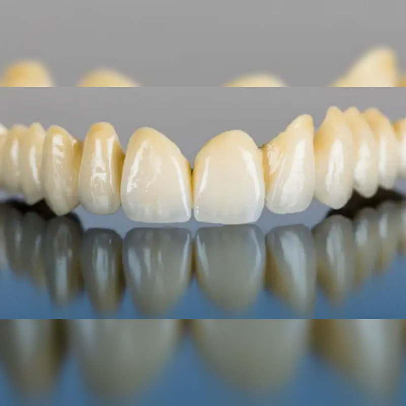 قیمت کامپوزیت لیرینگ