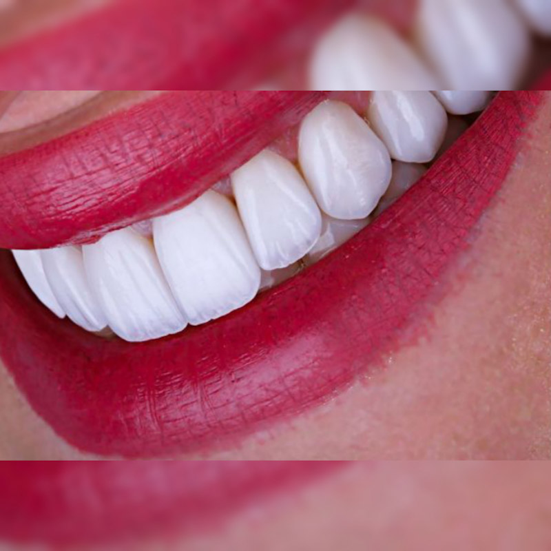 قیمت کامپوزیت نانو سرامیک