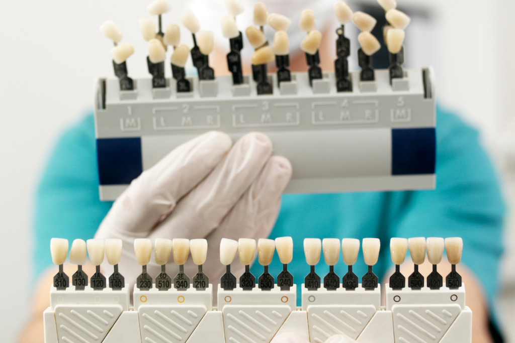 رنگ بندی کامپوزیت اولترادنت