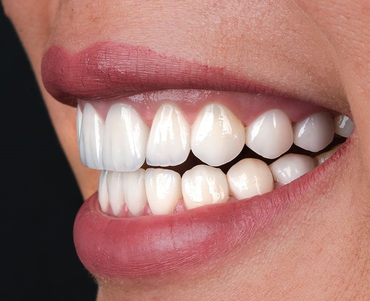 قیمت لمینت ایمکس