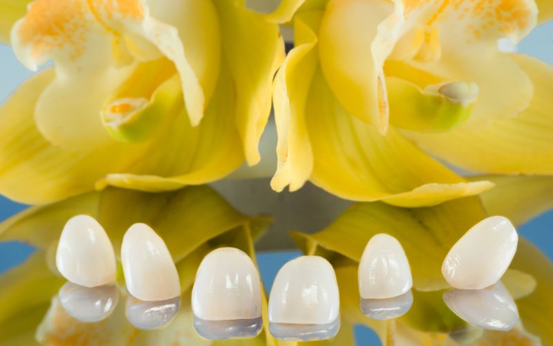 مراقبت های بعد از لمینت دندان