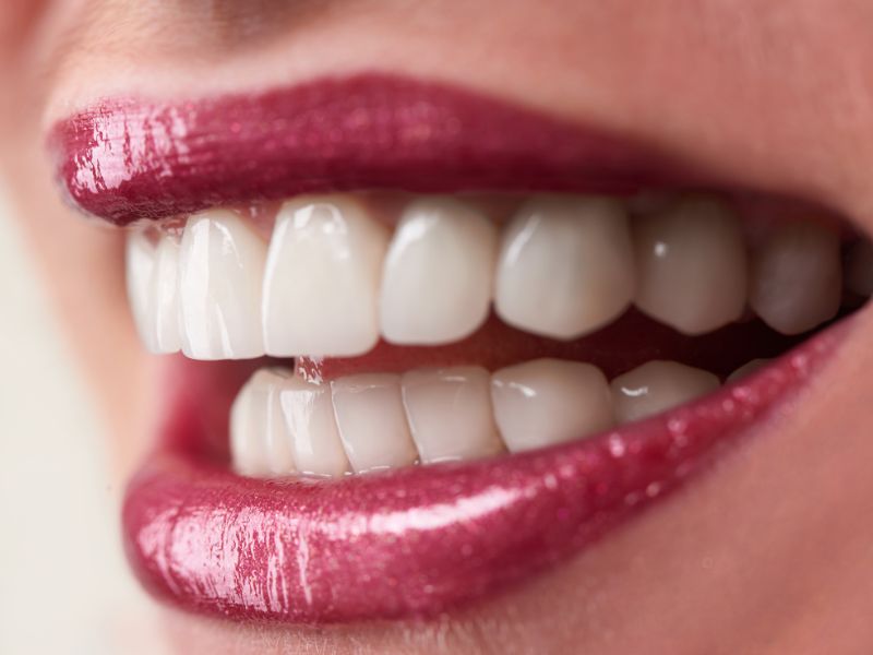 ایا کامپوزیت دندان درد دارد