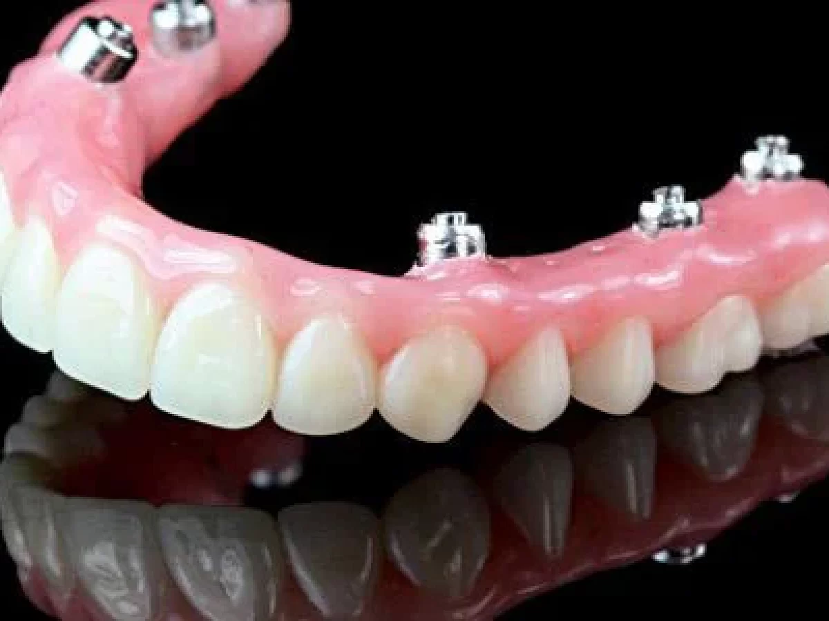 فیلم پروتز ثابت دندان