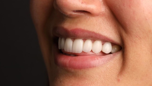 پرکردن دندان با کامپوزیت بهتر می‌باشد یا آمالگ