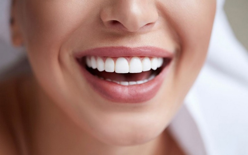 پشیمانی نسبت به لمینت دندان